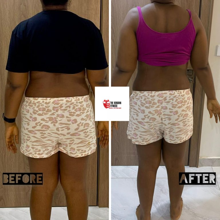 PCOS weight loss